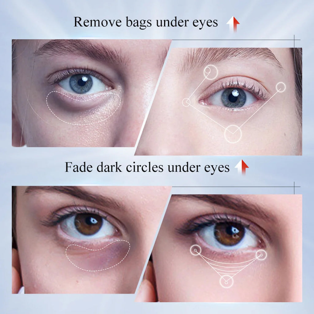 Kojic Acid Whitening Spot-removing Eye Cream Niacinamide Retinol Qme