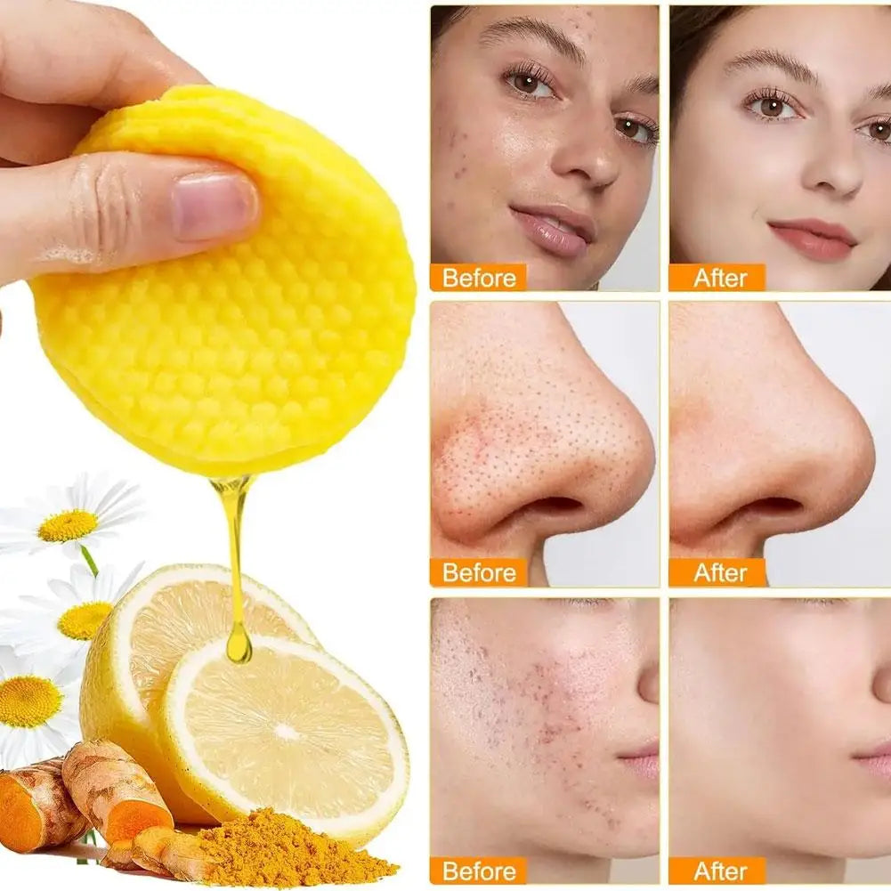 Turmeric Cleansing Pad Kojic Acid Sponges Exfoliating Pads-Acne Scars 50pcs Lemon Chamomile Deep Cleaning For Face Care Products Qme