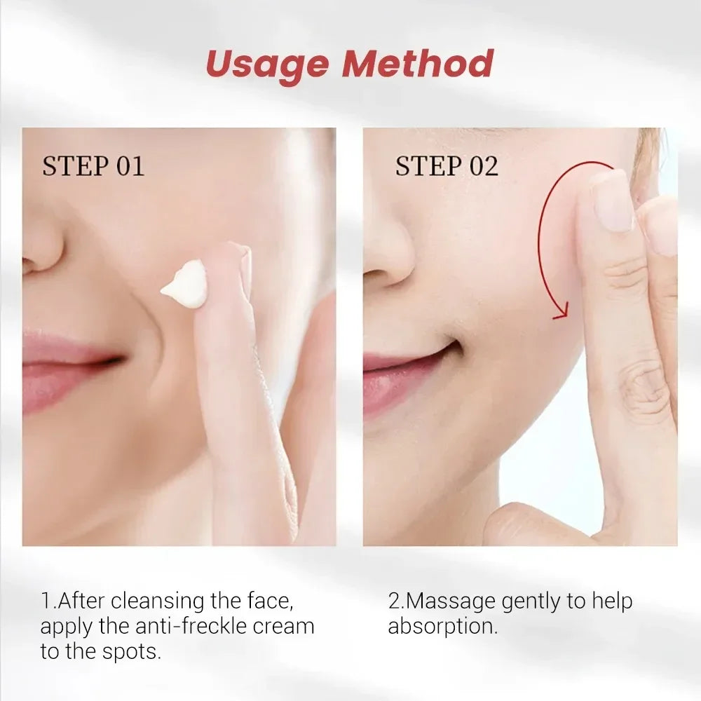 Whitening Freckle Cream Remove Dark Spot Anti Aging Fade Pigmentation Qme