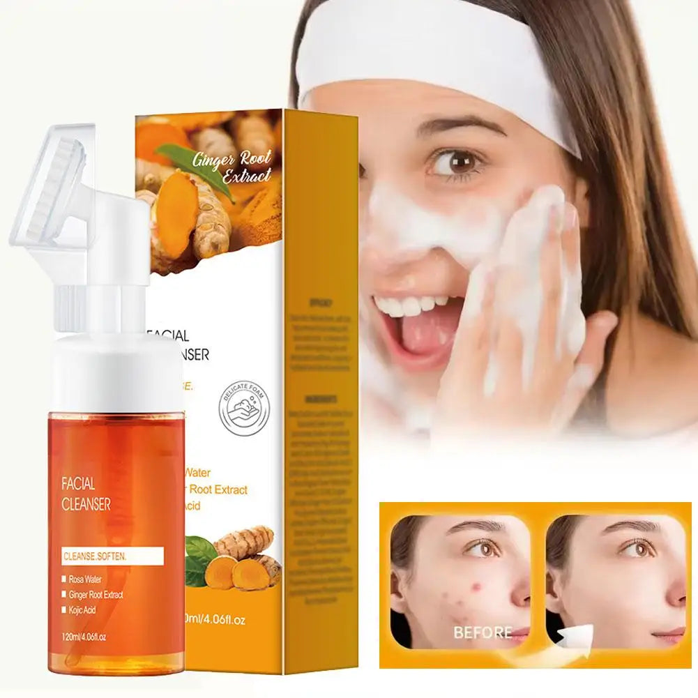 Turmeric Cleansing Mousse Anti Pimple Improves Dark Spot Oil Control Blackhead Remover Brighten Deep Hydrating Face Cleanser Qme