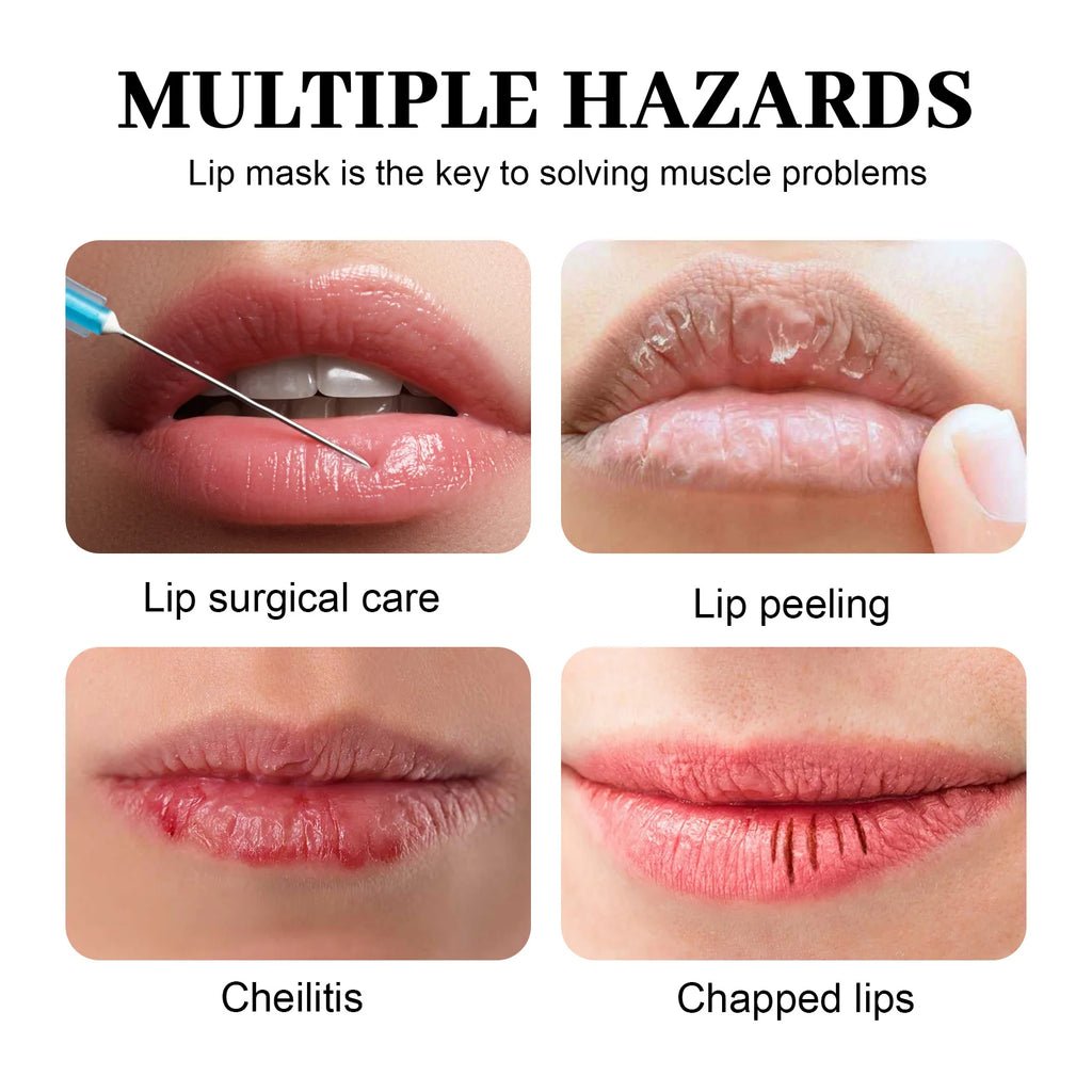 10Pcs Marine Collagen Lip Mask Nourishing Lip Care Moisture Fruits Essence Firming Moisturizing Labial Gel Patch Lips Pad Patche Qme