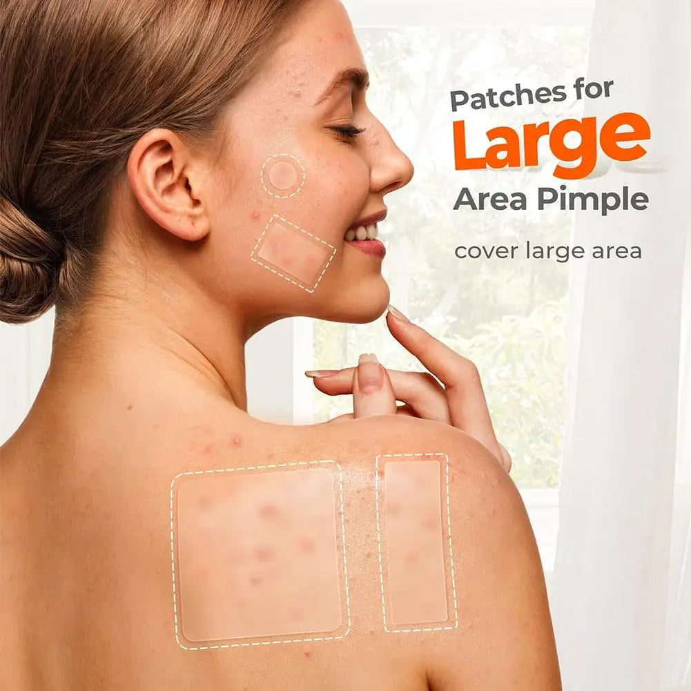 Acne Care Patch Anti-inflammatory Healing Absorbing Spot Sticker Qme