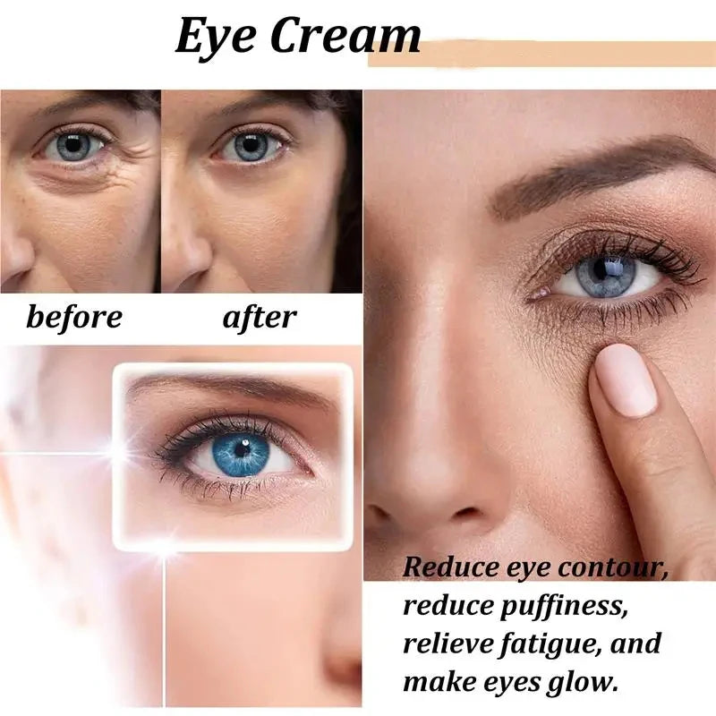 Retinol Eye Cream Remove Dark Circles Eye Bags Puffiness Reduces Wrinkle Eye Serum Stick Dark Circles Removal Man Woman Eye Care Qme