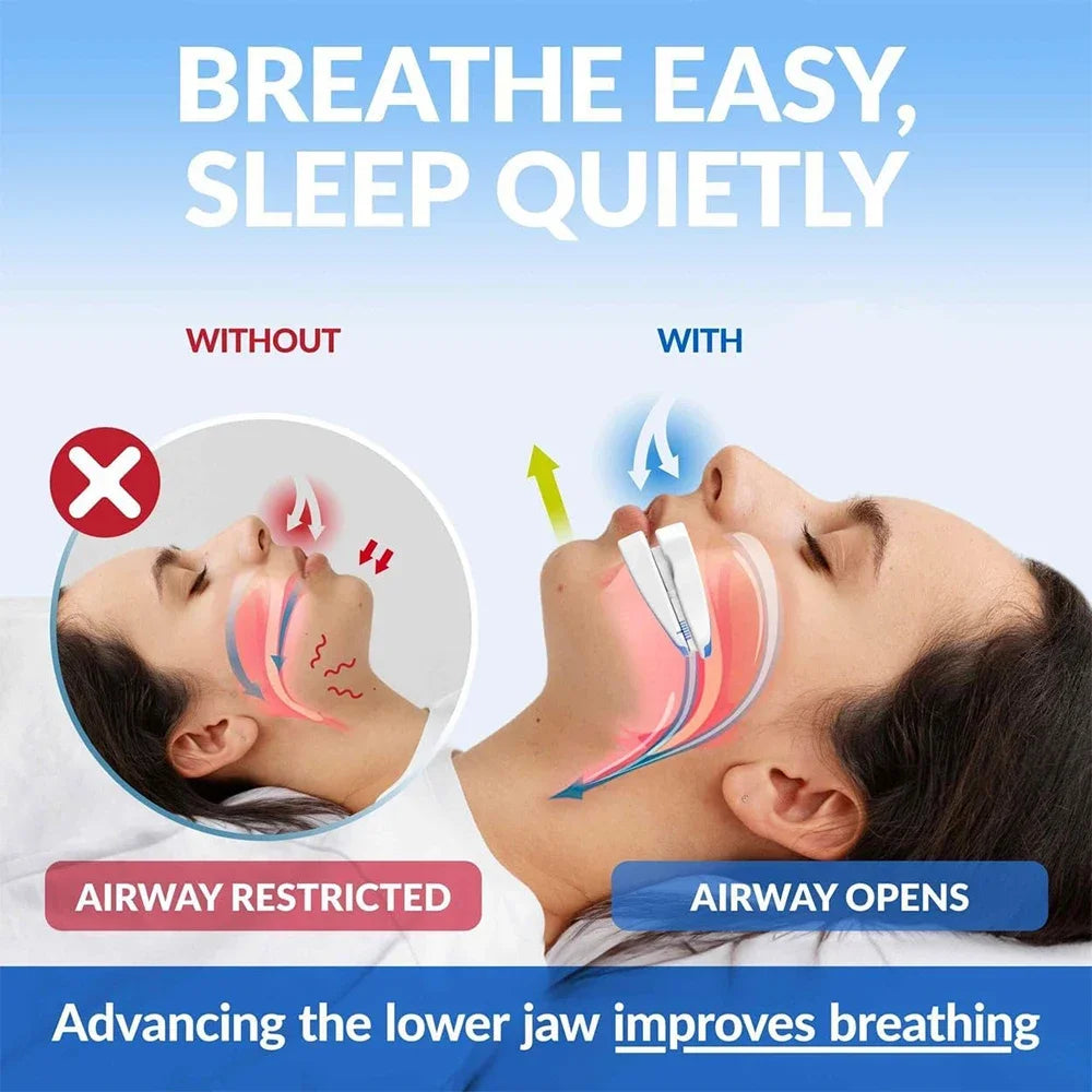 Adjustable Anti-snore Mouthpiece Sleeping Mouth Guard Stop Snoring Qme
